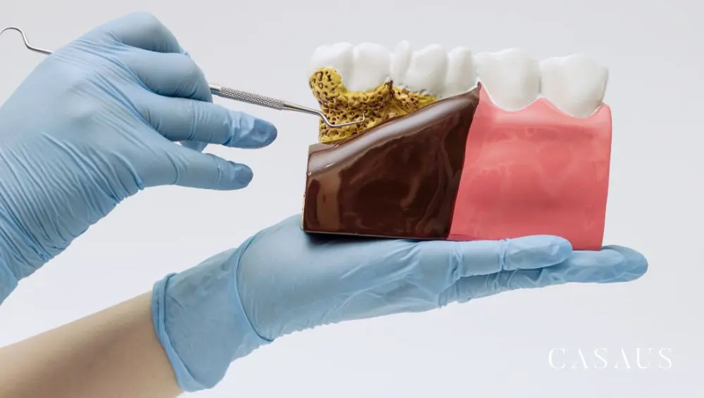 Tabaco y encías Clinica Dental Casaus en el Prat (Barcelona)