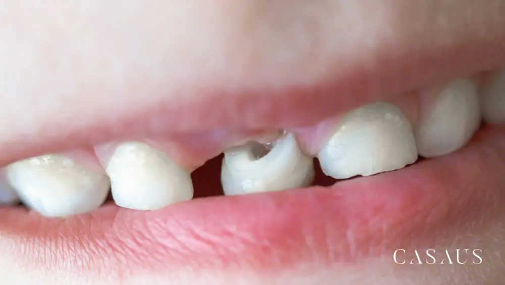 Dientes de leche en el Prat Clinica Dental Casaus