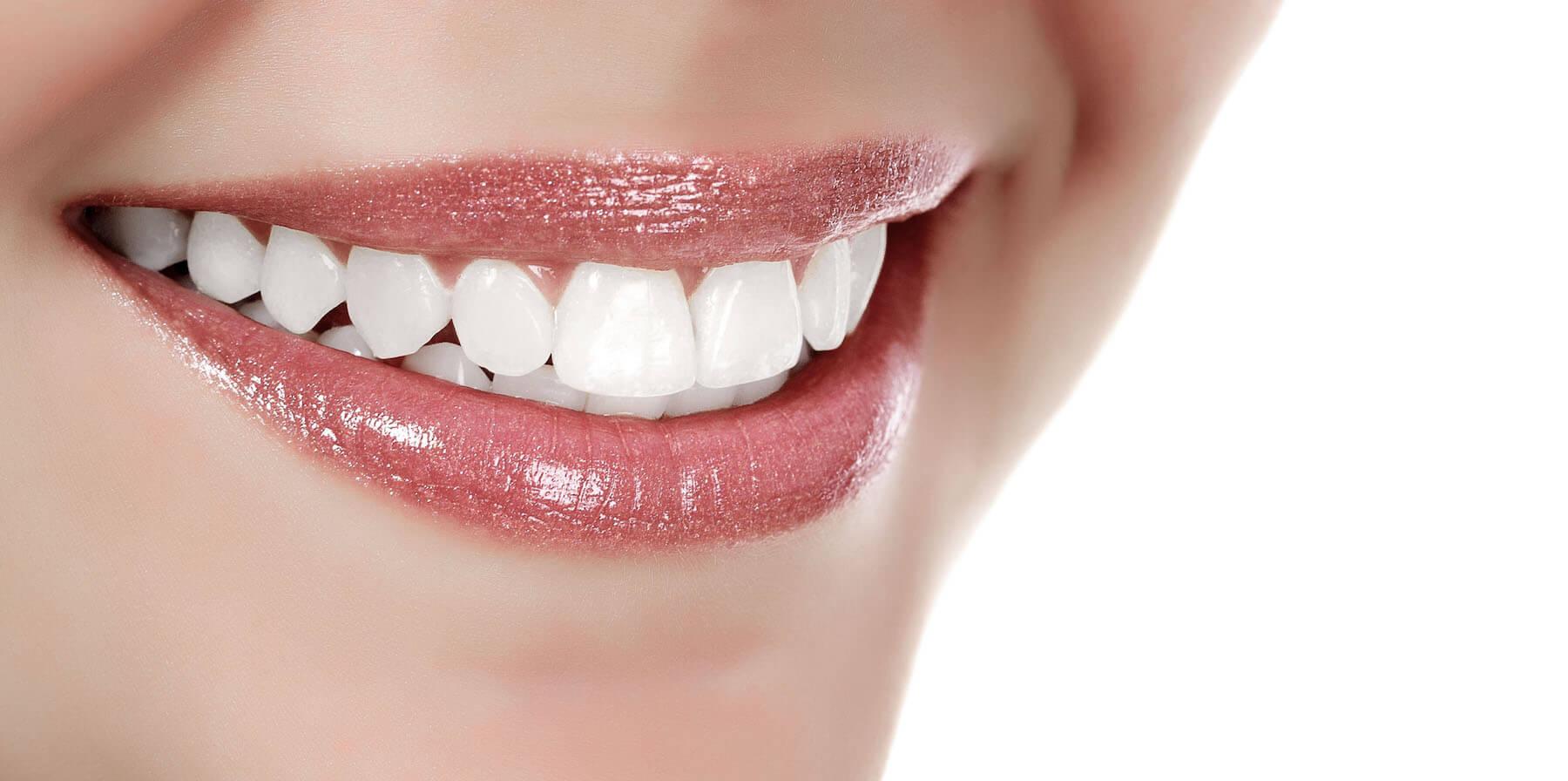 carillas-dentales-el-prat-disen%CC%83o-de-sonrisas