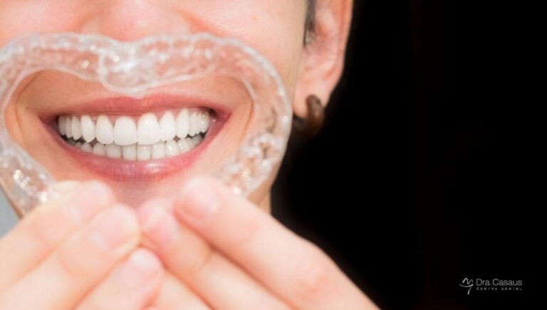 ortodoncia-invisible-ventajas-el-prat-llobregat-barcelona