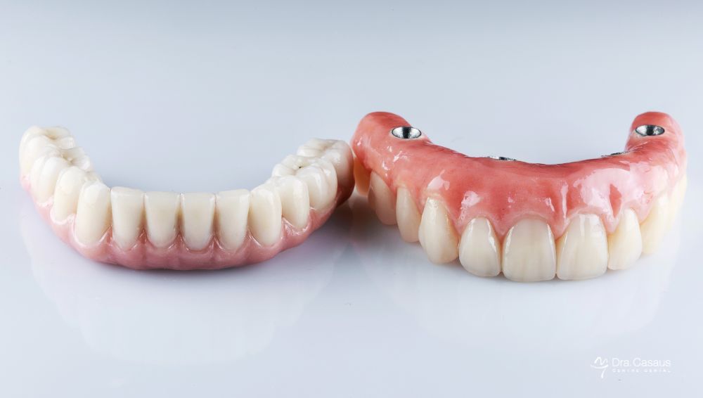 protesis-dentales-removibles-el-prat-CASAUS